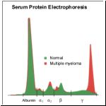 EletroforeseProteinasPlasma.gif